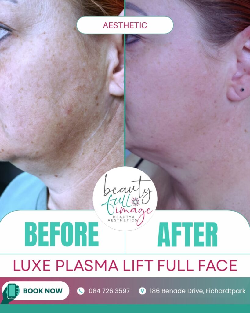 Beauty Full Image - Luxe Plasma