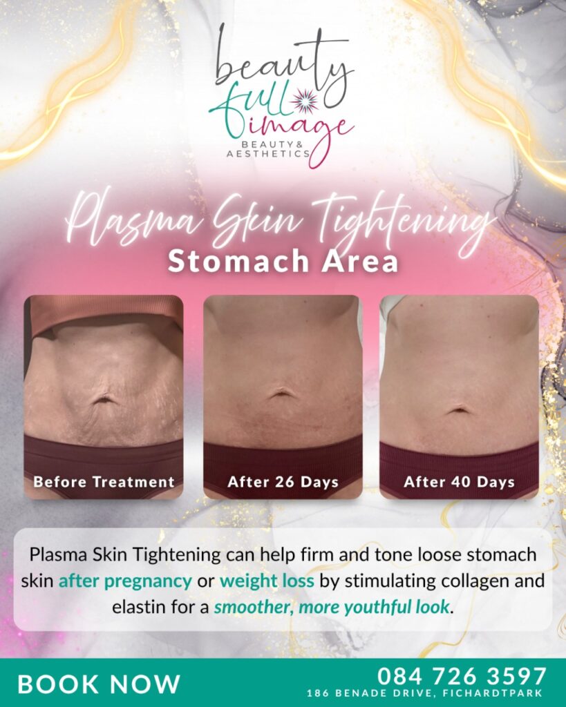 Beauty Full Image - Luxe Plasma