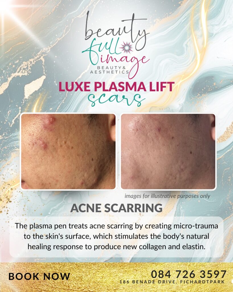 Beauty Full Image - Luxe Plasma