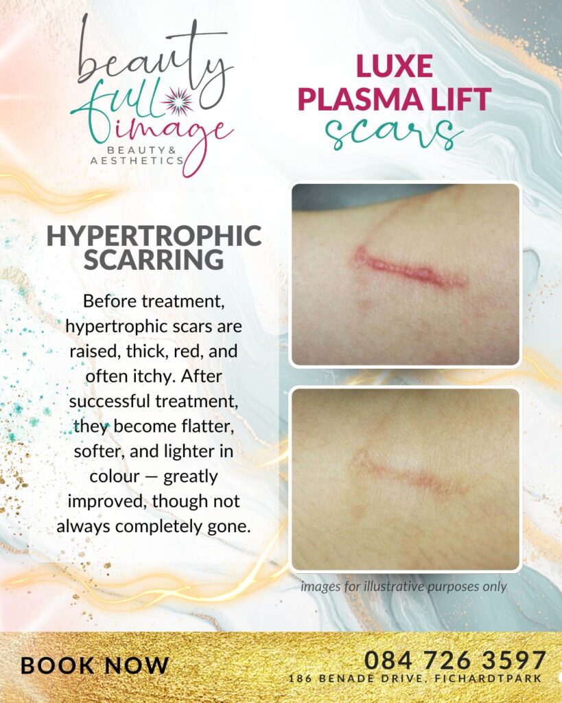 Beauty Full Image - Luxe Plasma