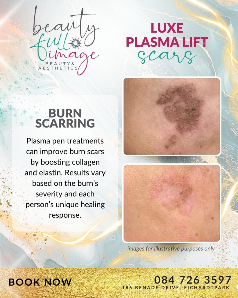 Beauty Full Image - Luxe Plasma