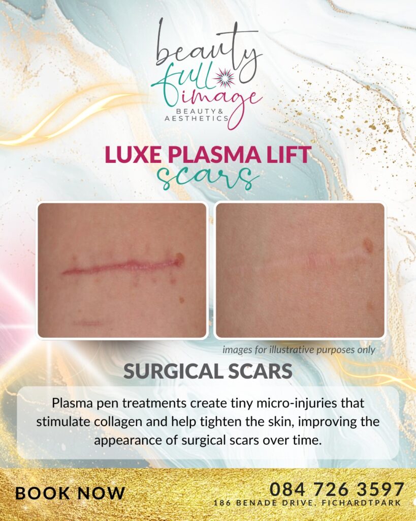Beauty Full Image - Luxe Plasma